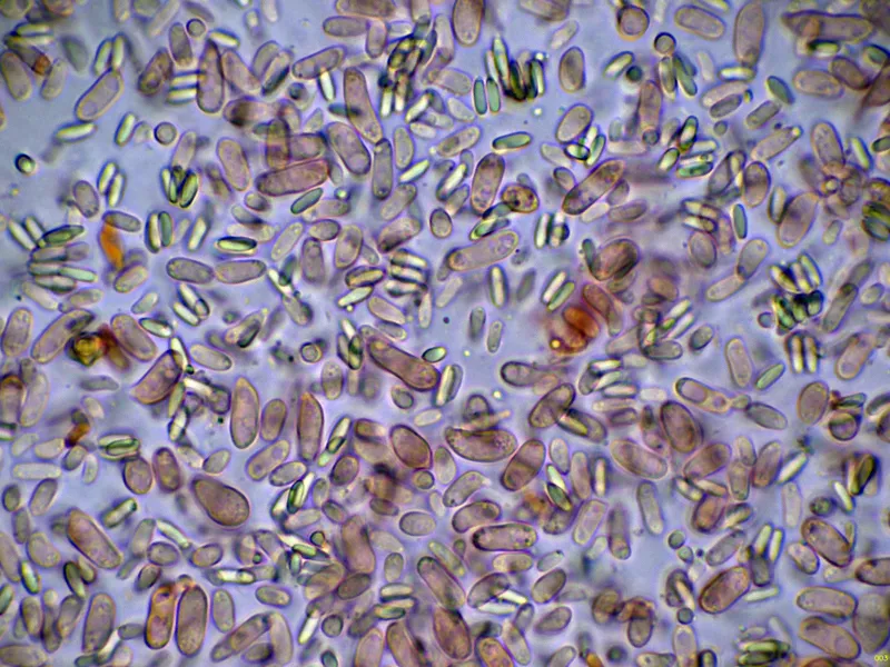 Clathrus ruber 10 - Basidios-003